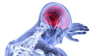 The 6 Most Effective Nootropics 8 The 6 Most Effective Nootropics 6
