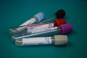 Blood Work For Brain Health 1